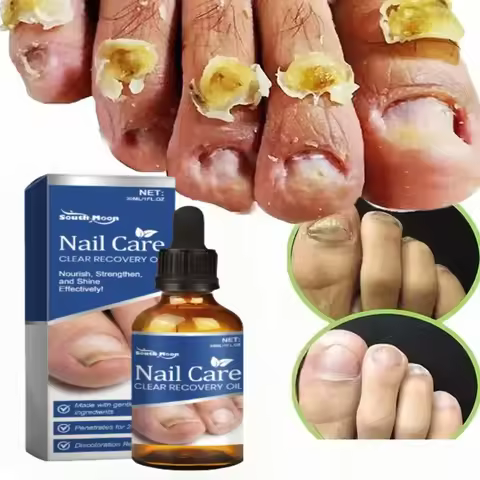 TRATAMIENTO ANTIHONGOS UÑAS EFECTIVO GOTAS