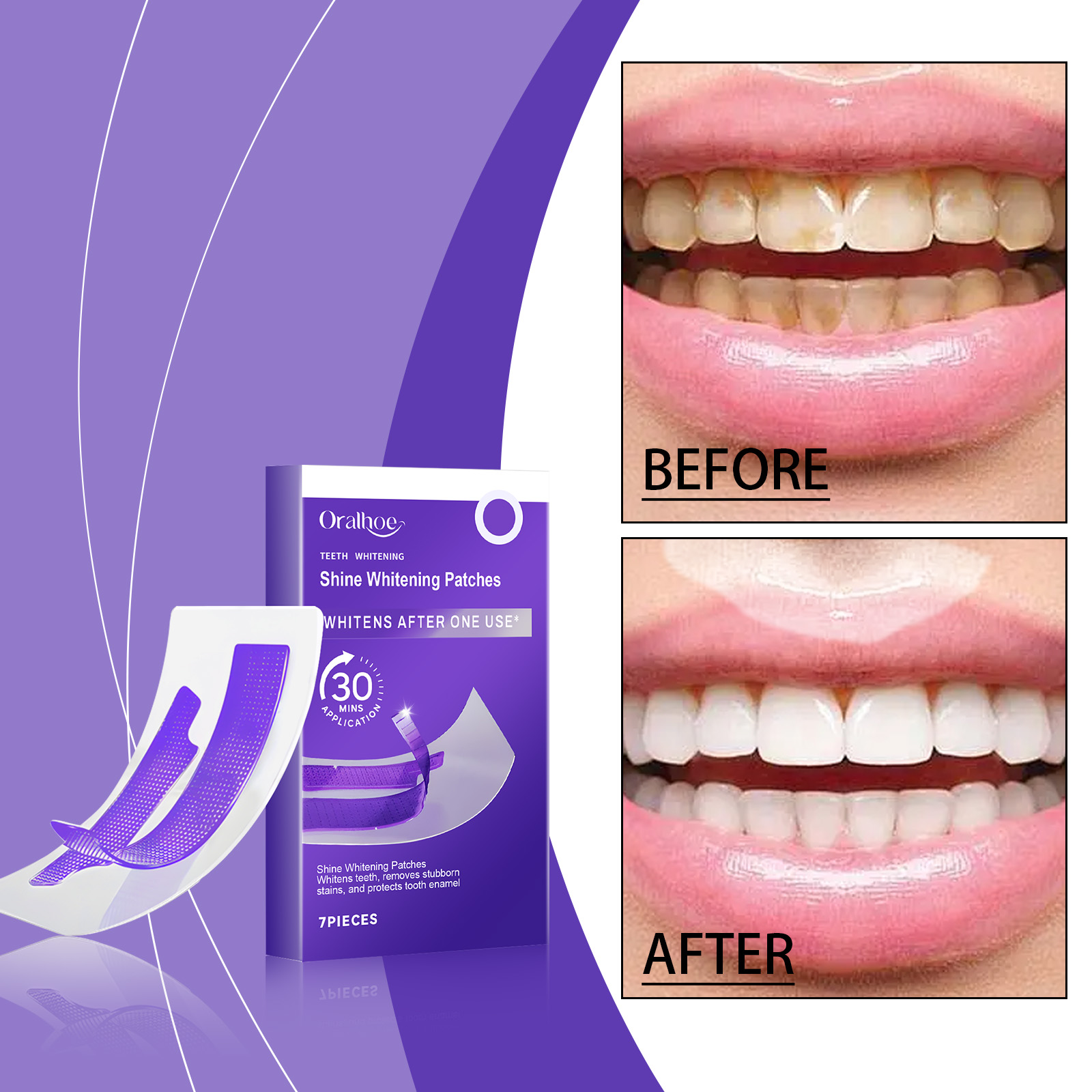 Whitening Stain Removing Teeth